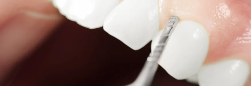 Reconstruction de la papille interdentaire