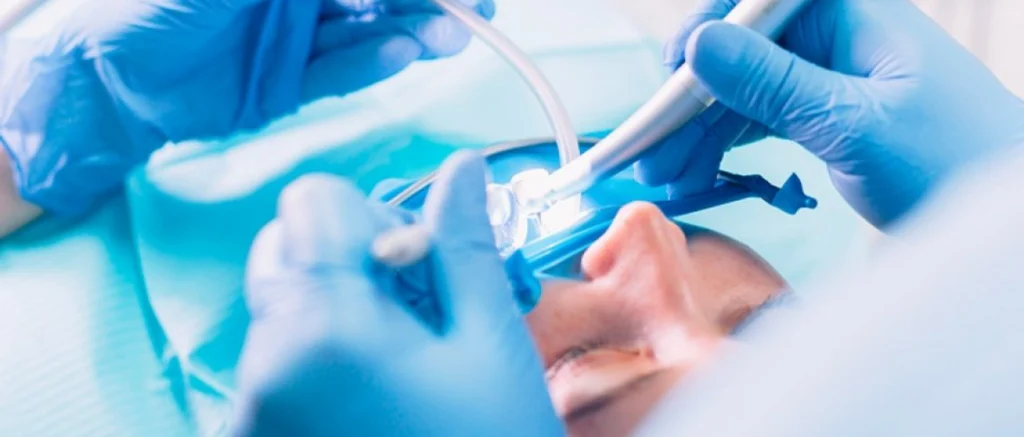 Implant dentaire immédiat